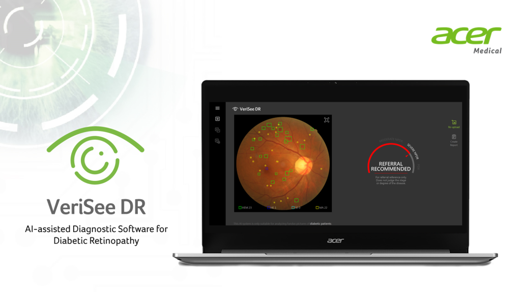 Acer Medical Inc. ร่วมกับ 4 โรงพยาบาลทดลองใช้งาน Verisee DR ซอฟต์แวร์วินิจฉัยภาวะเสี่ยงของโรคเบาหวานขึ้นจอประสาทตา เพิ่มช่องทางการเข้าถึงบริการทางการแพทย์ได้อย่างรวดเร็ว